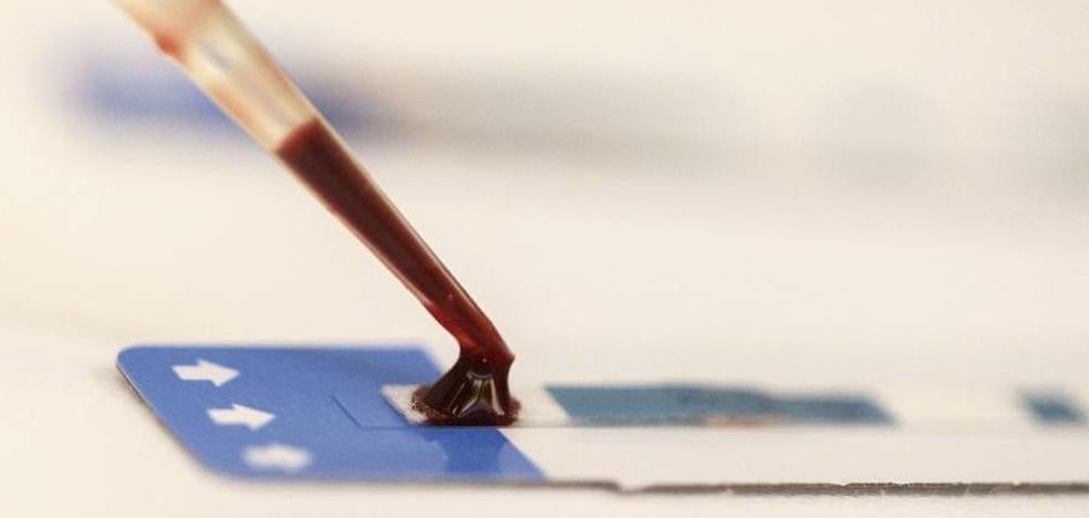 485 personas sufren sida en León, la segunda cifra más alta de la Comunidad