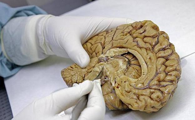 La provincia registra 17 donaciones de cerebro en un lustro y 106 leoneses ya han 'ofrecido' el suyo