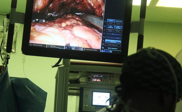 La cirugía robótica ha llegado para quedarse: 250 operaciones en seis meses y la tendencia va en aumento