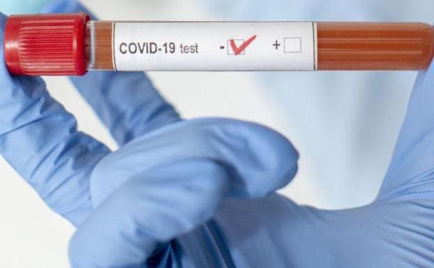 La provincia alcanza 26 positivos 'arrastrados', uno en las últimas 24 horas