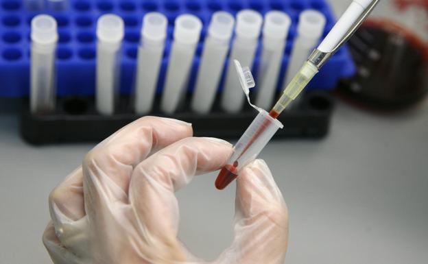 Cruz Roja busca sensibilizar a la sociedad leonesa del sida en el Día Internacional de la prueba del VIH