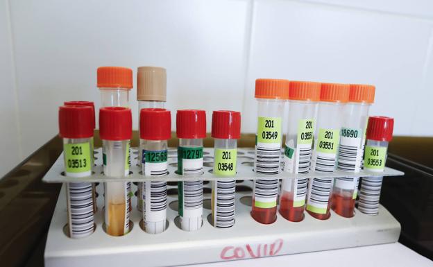 El desgaste de la plantilla deja un déficit de 80 enfermeras en el Hospital de León