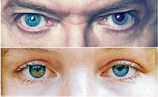 David Bowie y más famosos con un ojo distinto del otro