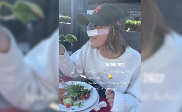 Anna Padilla anuncia que se ha sometido a una rinoplastia