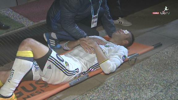 Van Persie no perderá el ojo izquierdo