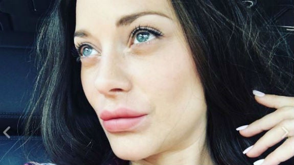 Lo que oculta Marion Cotillard tras las fotos con los labios a lo Kylie Jenner